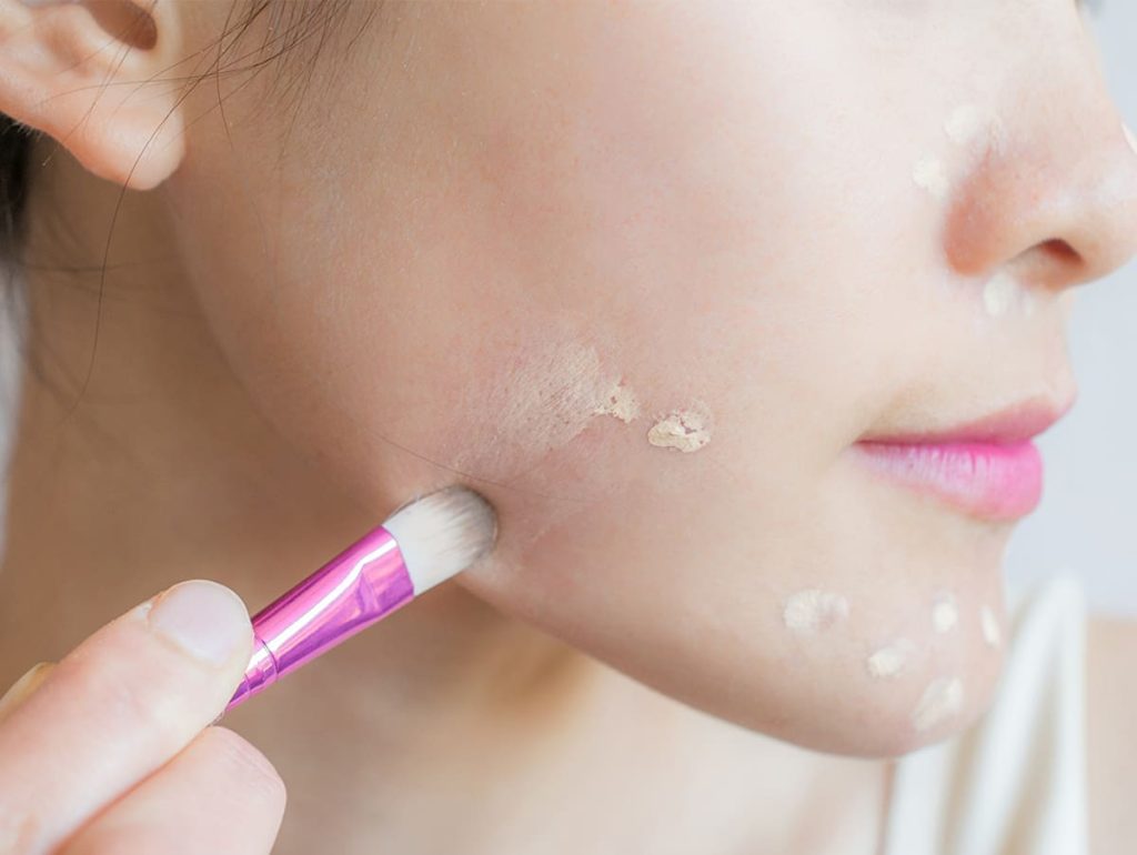 کانسیلر زدن برای ناپدید کردن لکه تو صورت