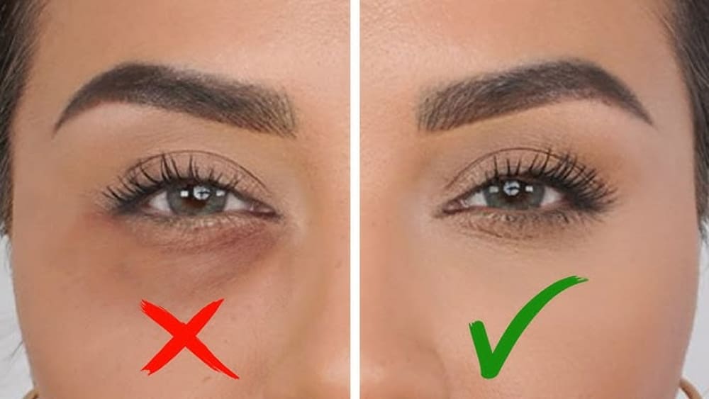 سیاه شدن زیر چشم بعد از ریمل