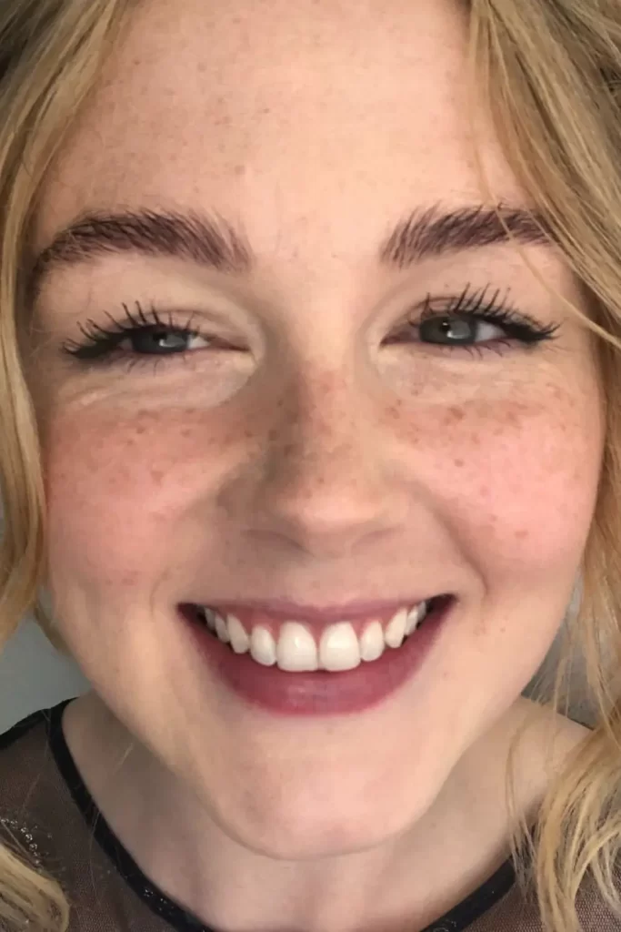 دختر بلوند و خندان با آرایش صورت کک و مک دار